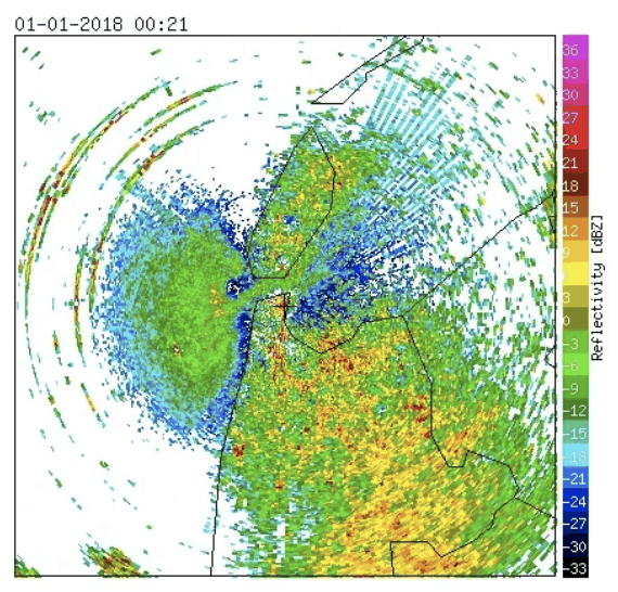 Radar